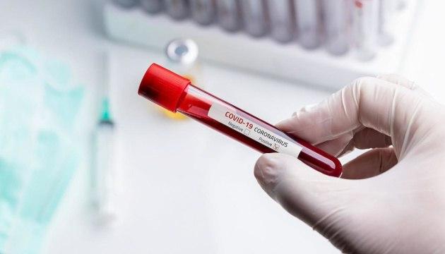 В Украине за сутки зафиксировали 807 новых случаев коронавирусной болезни COVID-19