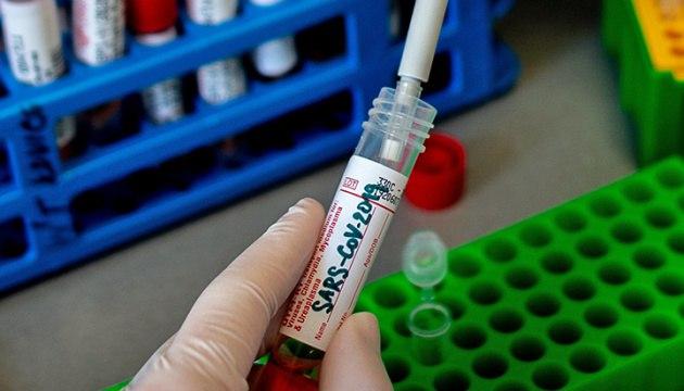 В Украине за сутки зафиксировали 543 новых случая коронавирусной болезни COVID-19