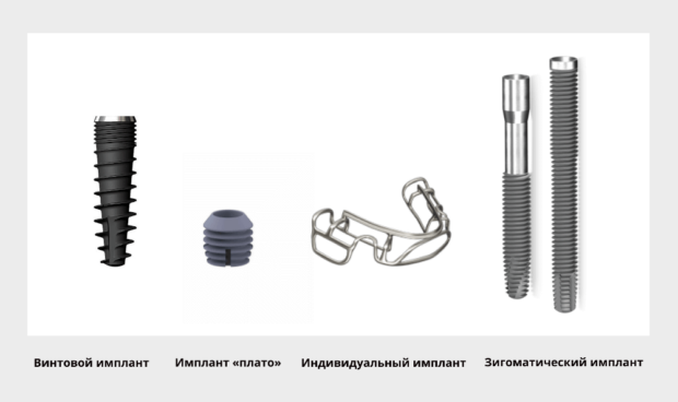 Зубні імпланти