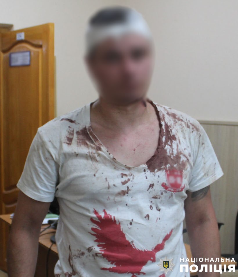У Києві повідомили про підозру чоловіку, який ножем тяжко травмував свого товариша
