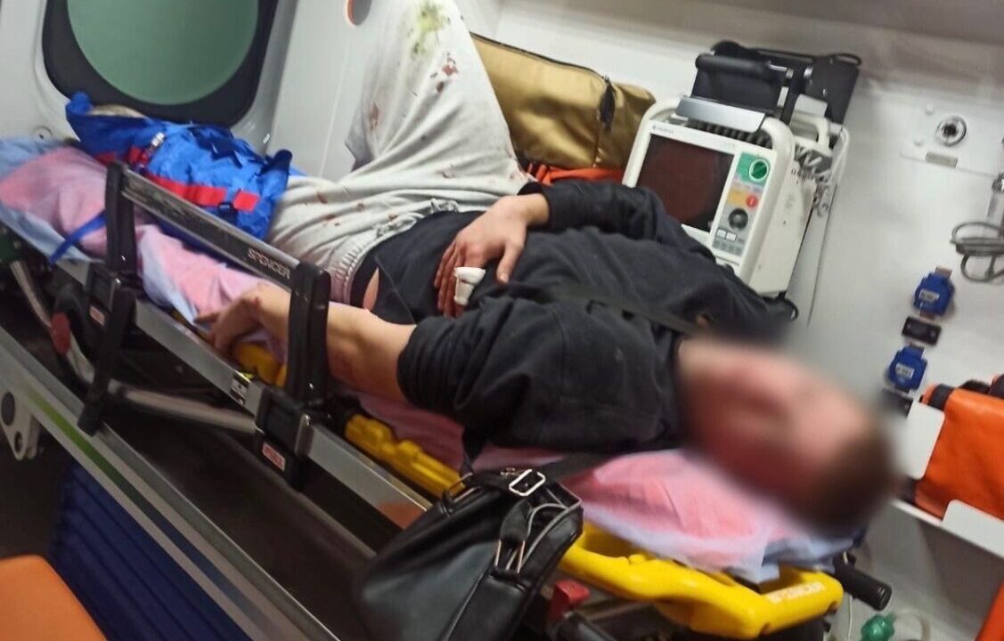 У Києві п’яний молодик поранив чоловіка через відмову пригостити сигаретою (фото)