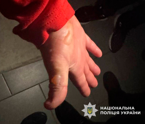 Київ: чоловік підпалив автомобіль через ревнощі - затриманий поліцією