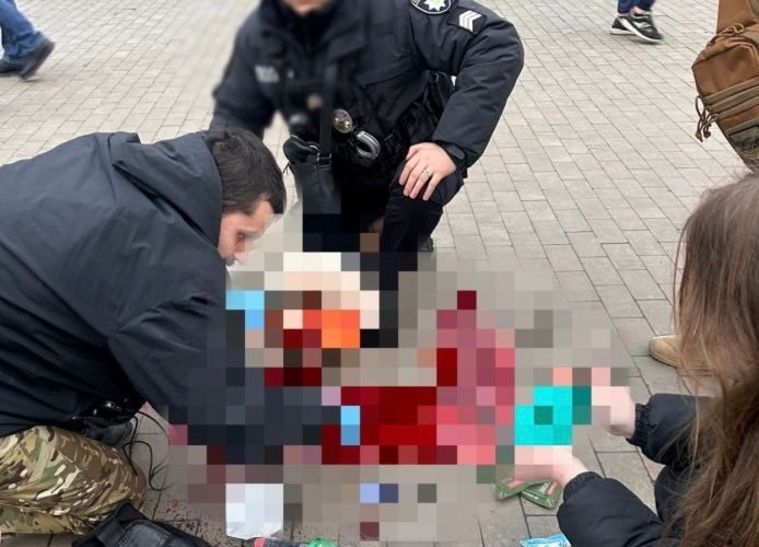 У Києві від поранень при обстрілі померла 48-річна жінка