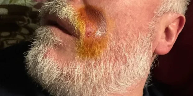 Кур'єр Glovo побив літнього чоловіка у Києві: що відомо про скандал