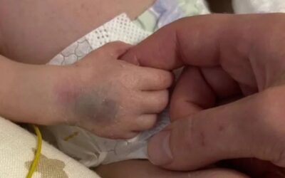Немовля, мати якого загинула під час російської атаки на Київ, виписується з лікарні