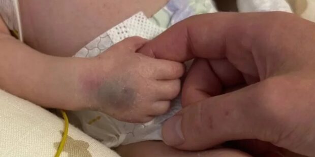 Чудо порятунку: немовля виписується з лікарні після трагічної атаки РФ на Київ