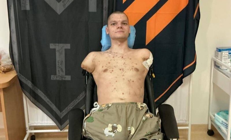 У Києві ветеран без кінцівок не зміг отримати банківську картку у ПриватБанку: глава НБУ відреагував