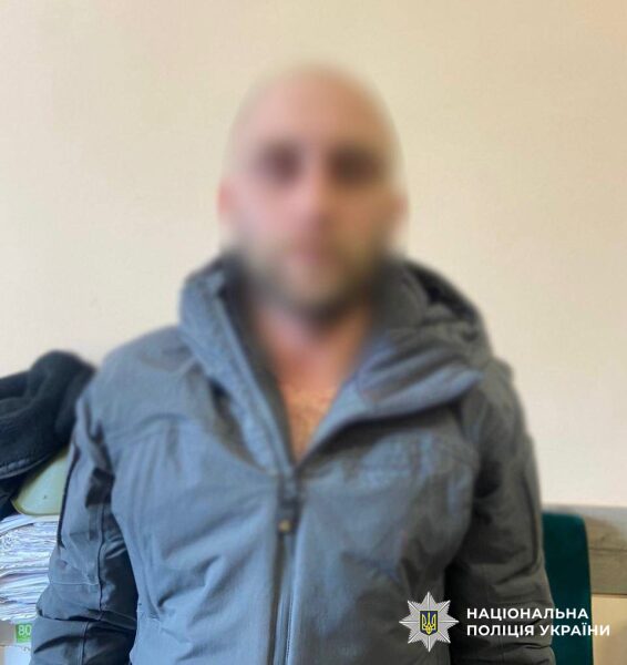 У готелі в центрі Києва іноземець жорстоко побив чоловік: потерпілий втратив око