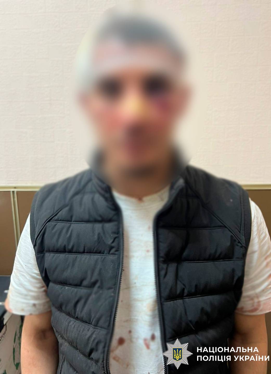 Поліція затримала іноземця за напад з ножем у Печерському районі Києва