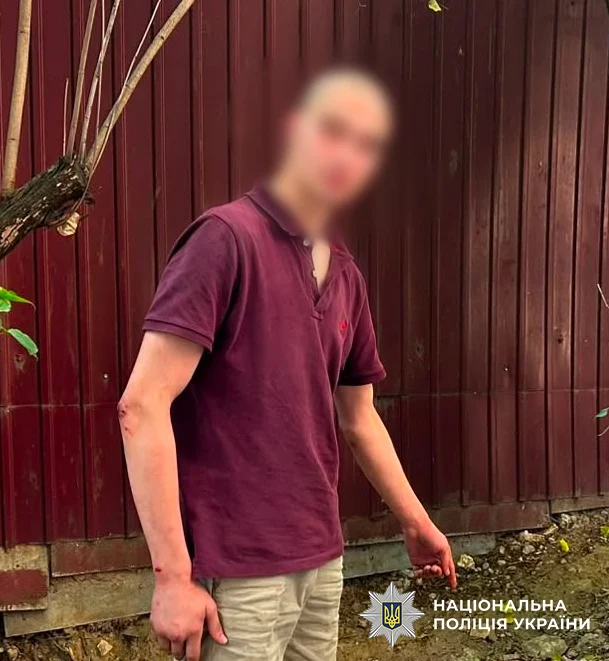 Хотів вразити дівчат «пуском сигнальних ракет»: правоохоронці повідомили про підозру 20-річному киянину
